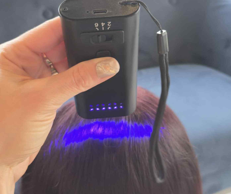 V-light UV technika